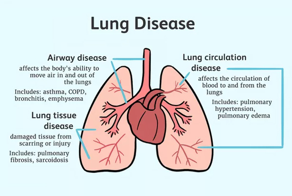 Lung Disease