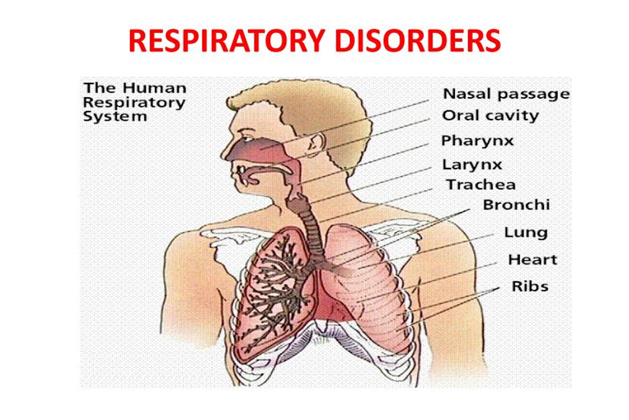 Respiratory Disorders