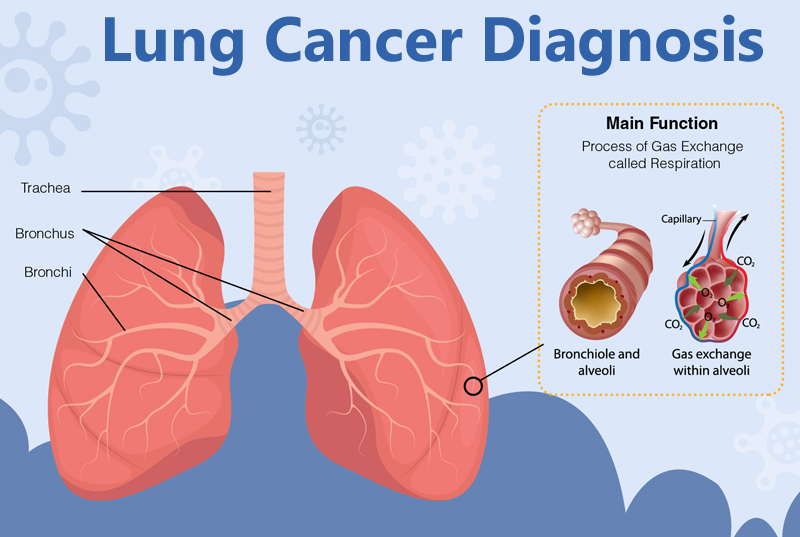 Respiratory Disorders